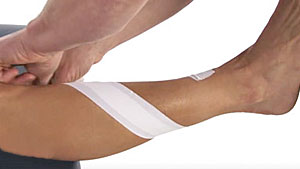 Anterior shin splints taping