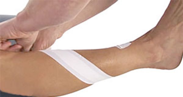 Anterior shin splints taping