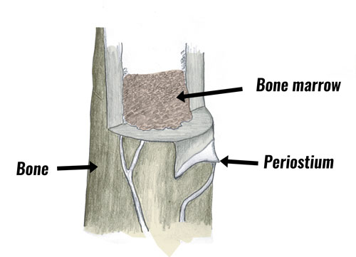 Shin splints periostium