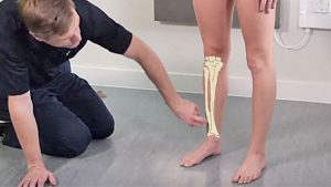 Shin splints taping