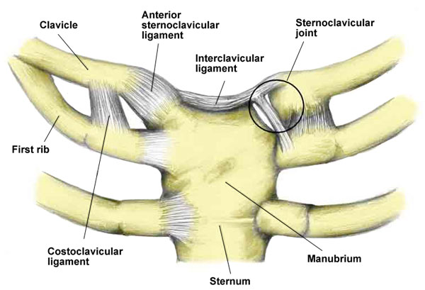 Costochondritis anatomy ribs sternum