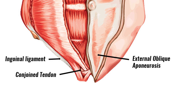 Gilmore's groin anatomy