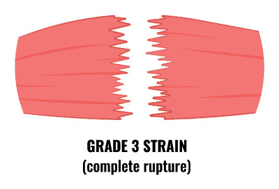Tear vs. Tear - Usage, Difference & Meaning