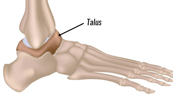 Osteochondral Lesions of the Talus