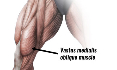 Vastus medialis oblique muscle