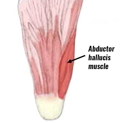 Abductor hallucis muscle