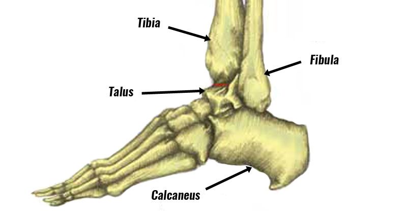 Dislocated ankle bones