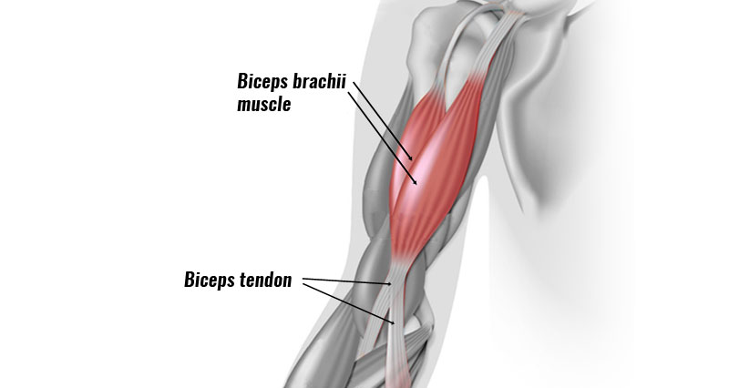 Regnfuld Nøgle Lille bitte Biceps Tendonitis at the Elbow - Symptoms, Causes & Treatment.