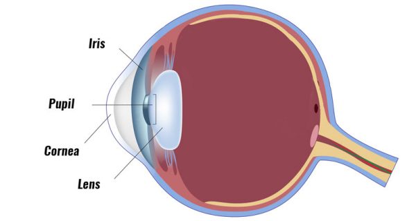 Corneal abrasion
