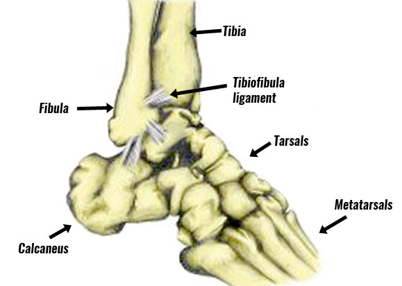 Ankle anatomy high ankle sprain