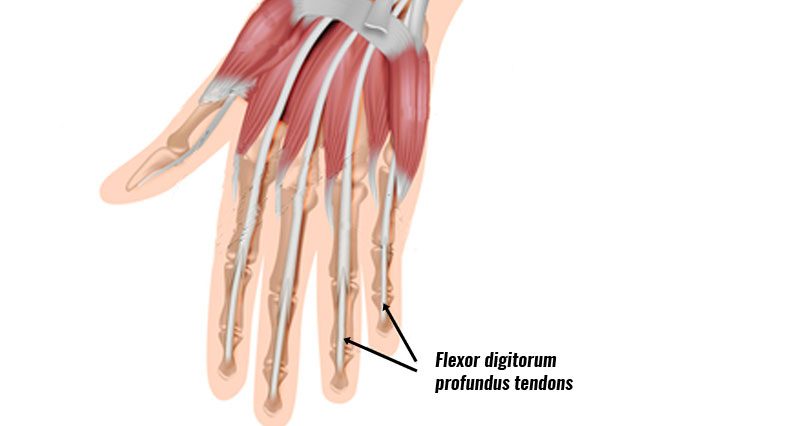 Jersey finger tendons