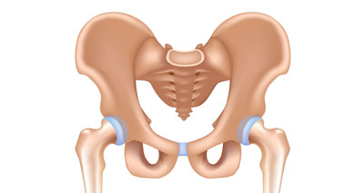 Pelvic fracture goin pain