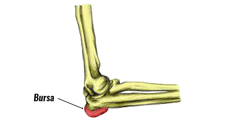 Students Elbow bursitis