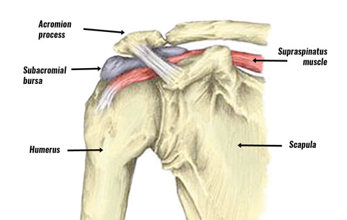 Subacromial bursitis anatomy