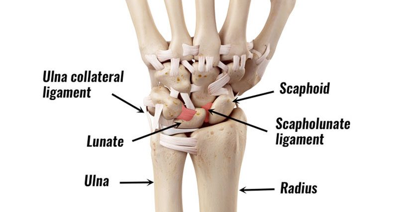 MCL Tear Causes & Treatment  Florida Orthopaedic Institute