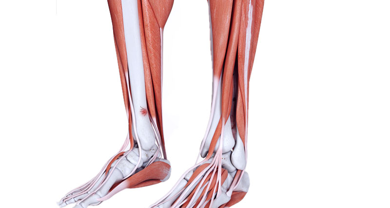 Tibia stress fracture