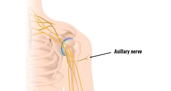 Axillary nerve injury