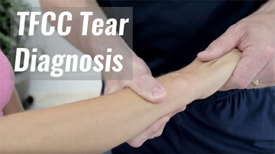 nok krater liste TFCC Tear - Symptoms, Causes, Treatment & Surgery Explained