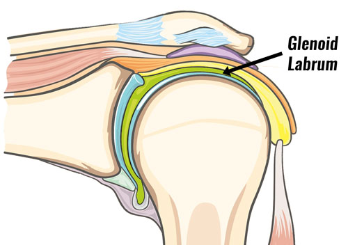 Glenoid labrum