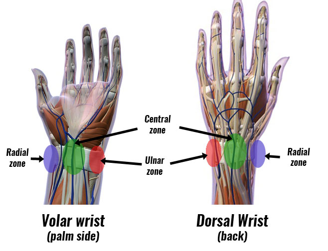 Wrist pain zones - volar,  palmer, ulnar, radial