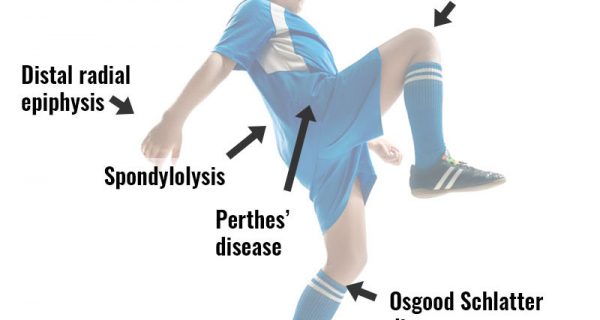 Childrens sports injuries