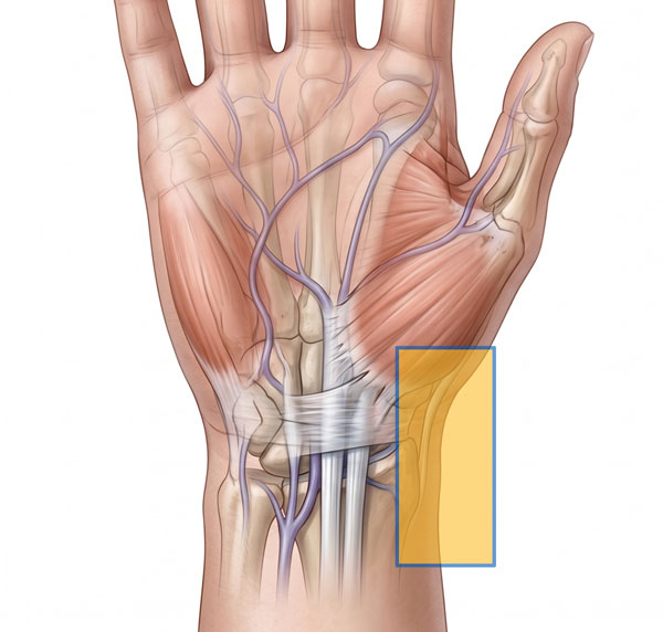volar-radial-wrist-pain600