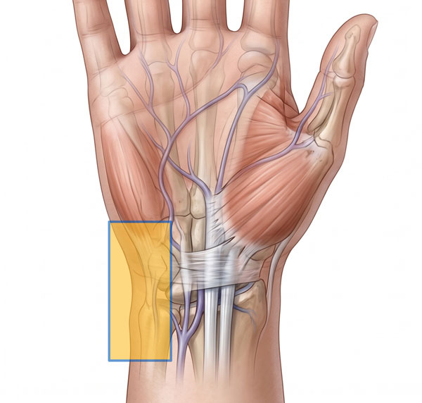 volar-ulna-wrist-pain600