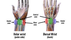 Volar Dorsal wrist pain