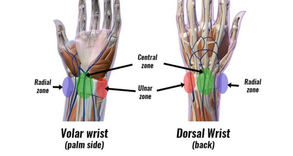 Volar Dorsal wrist pain