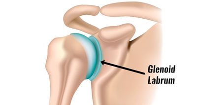 Glenoid labrum dislocated shoulder