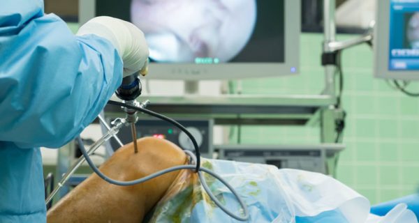 Knee surgery for ACL sprain