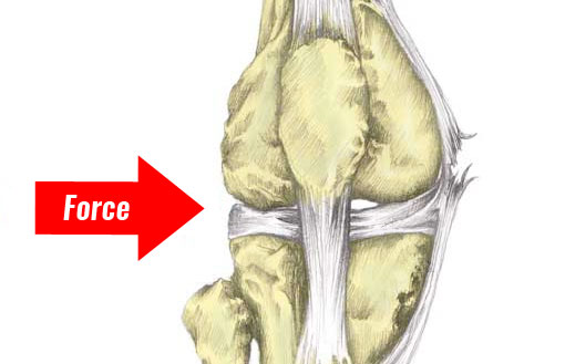 MCL sprain mechanism