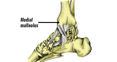 inside ankle pain