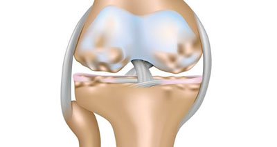 osteoarthritis lateral knee pain
