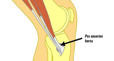 Medial Knee Pain Inside Symptoms Causes Treatment Rehab