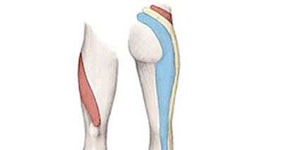 posterior thigh pain from the sciatic nerve