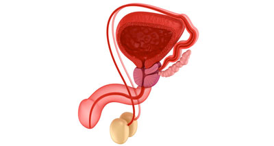 spermatic cord torsion