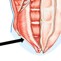 Groin Pain - Groin Injuries - Symptoms, Causes & Treatment