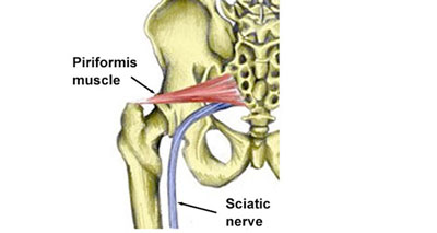 piriformis muscle