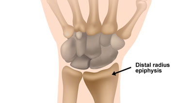 Radial epiphysis