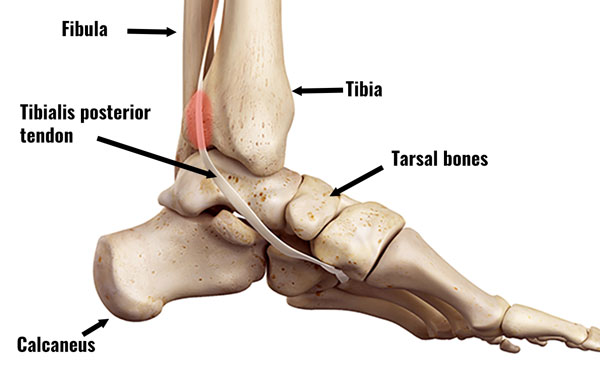 Tibialis posterior tendon