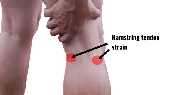 posterior knee pain stretching