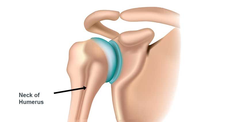 neck of humerus
