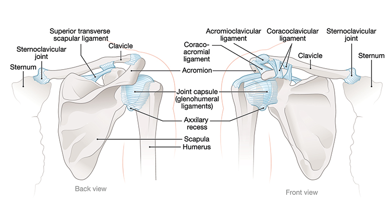 Shoulder ligaments sprain