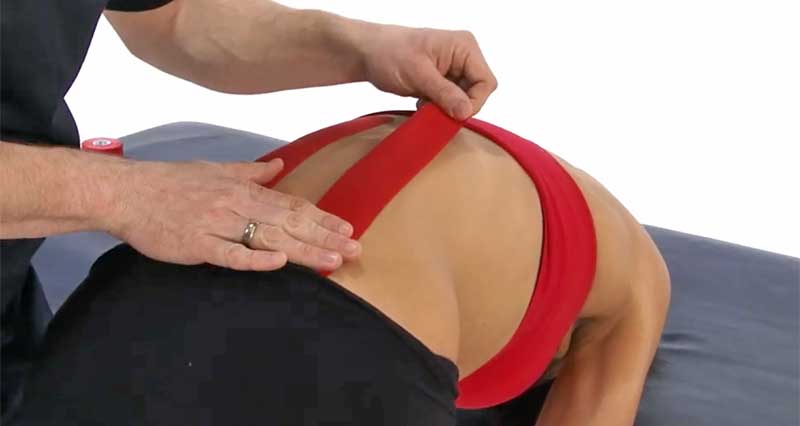 kinesiology taping for low back