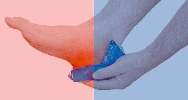 hot or cold therapy for sports injuries