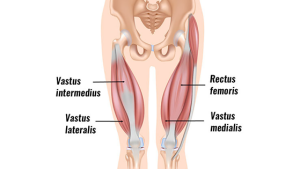 Resisted Hip Flexion Test (Rectus femoris strain) - Sportsinjuryclinic.net