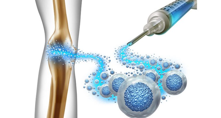 stem cell therapy in sport