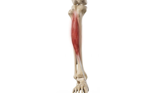 anterior compartment syndrome