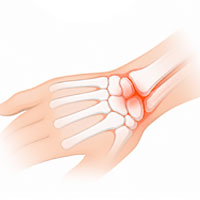 wrist rehab exercises